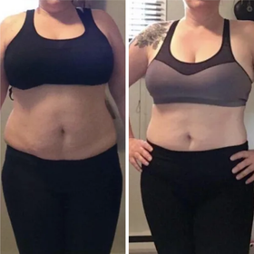 Comparación frontal antes y después de mujer con reducción en abdomen y cintura gracias a Vibro Sculpt